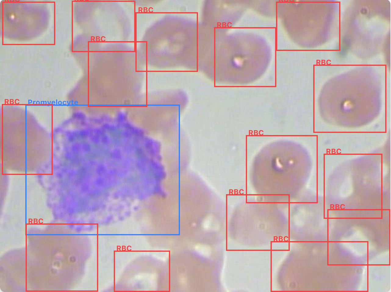 Blood Cell Anomaly Detector